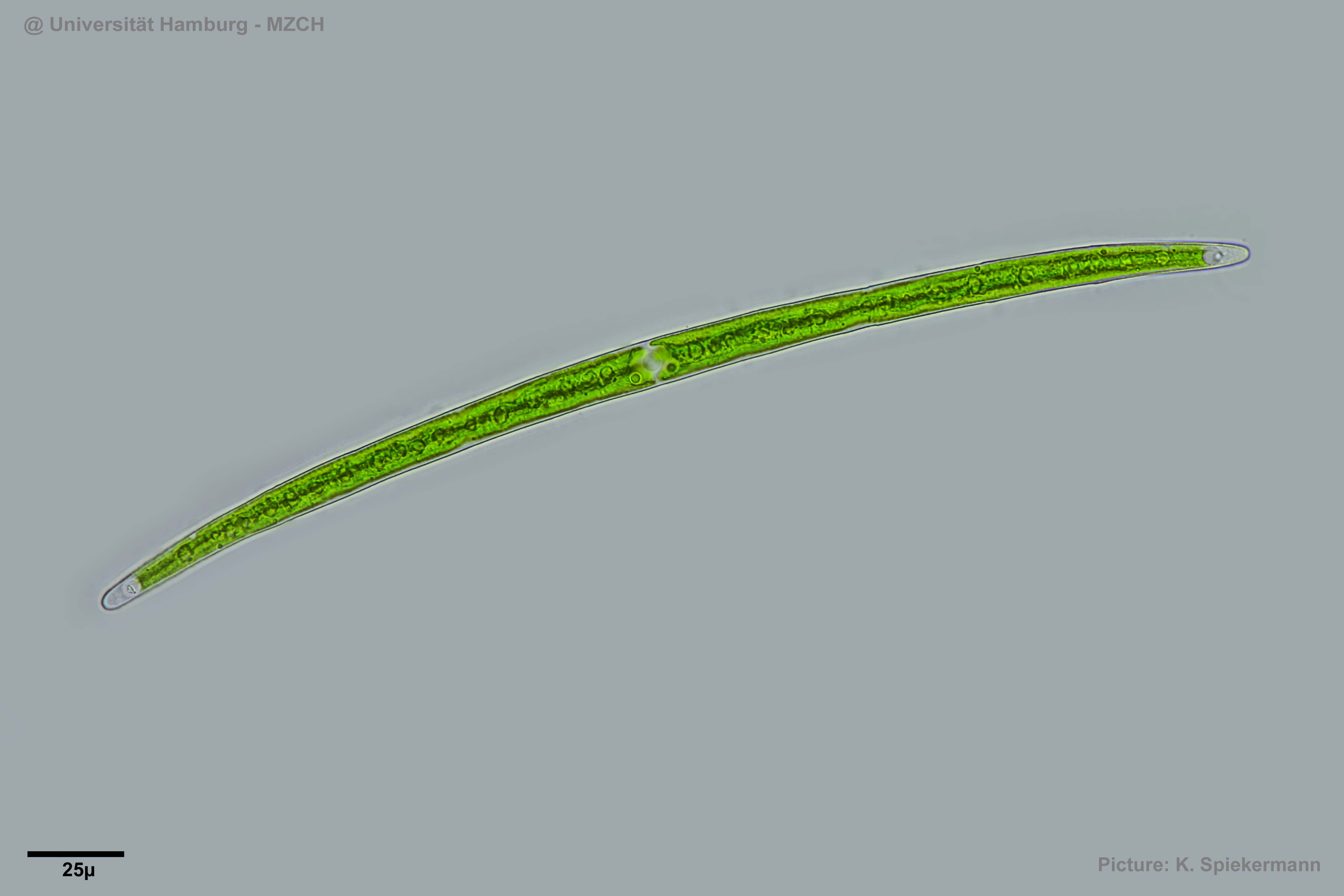 206_Closterium praelongum